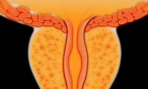 Cơ thể nam giới xuất hiện 3 bất thường này, hãy chú ý bệnh tuyến tiền liệt