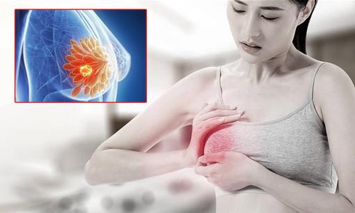 Bệnh ung thư vú có dấu hiệu ở giai đoạn đầu nhưng nhiều người lại bỏ qua vì không có cảm giác đau