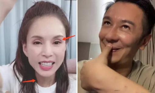 Cặp đôi 'Thiên long bát bộ' hội ngộ: Lý Nhược Đồng gầy gò và lão hóa, Trần Hạo Dân mặt ngày càng kỳ quặc