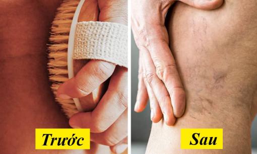 7 thói quen tưởng chừng như vô hại nhưng có thể hủy hoại mạch máu của bạn 