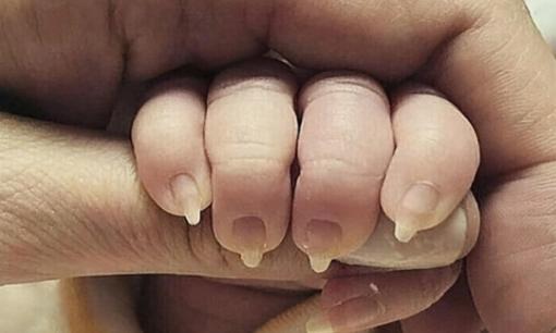 Mẹ khoe ảnh móng tay của em bé khiến toàn bộ dân mạng tức giận! Hành động vô trách nhiệm có thể khiến đứa trẻ bị mù