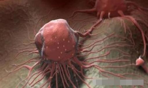 Nếu có 5 'đặc điểm' ở bụng thì 80% trong số đó đã là 'ung thư' rồi