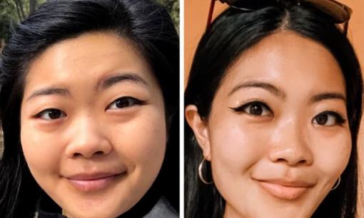 Ăn bao nhiêu vào mặt hết, loạt ảnh chứng minh giảm cân có thể thay đổi khuôn mặt, là phương pháp 'phẫu thuật thẩm mỹ' tốt nhất!