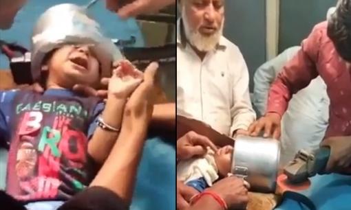 'Toát mồ hôi’ giải cứu cậu bé bị kẹt đầu trong nồi áp suất