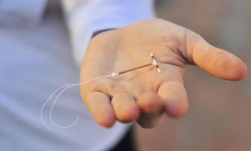 Phụ nữ cần lưu ý 3 điều sau khi đặt vòng tránh thai?