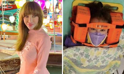 'Thảm họa mặt rắn' Tiết Chỉ Luân gặp tai nạn xe hơi, hình ảnh nằm trên cáng gây chú ý 