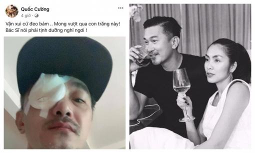 Diễn viên Quốc Cường đăng ảnh bị thương phải băng một bên mắt khiến dàn sao Việt lo lắng