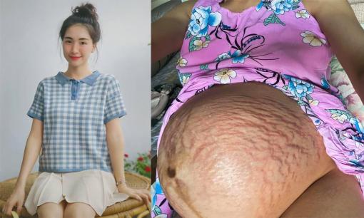 Nhận được sự quan tâm khi hé lộ hình ảnh rạn da lúc mang bầu, Hòa Minzy có phản ứng gì?