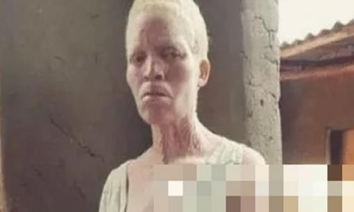 Người 'quý' nhất hành tinh, cơ thể đắt hơn vàng, ngày nào cũng cần cảnh sát bảo vệ