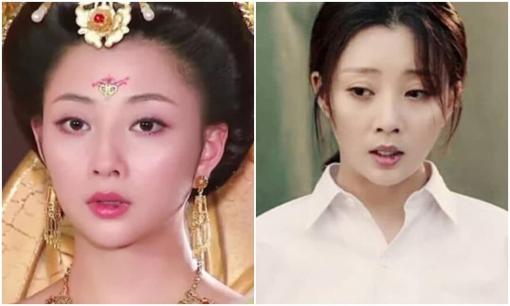 Tại sao 'Dương quý phi xấu nhất màn ảnh Hoa ngữ' luôn có một 'vảy máu' trên miệng? Ai cũng nghĩ đó là bệnh nhưng sự thật là...