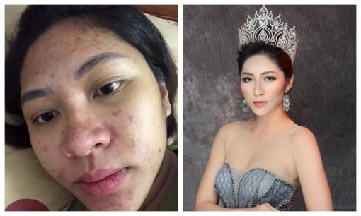 HH Đại dương Đặng Thu Thảo tiết lộ nguyên nhân ly hôn: Chồng ngoại tình vì vợ xuống sắc khi mang bầu, bị kẻ thứ ba khủng bố đến điên dại