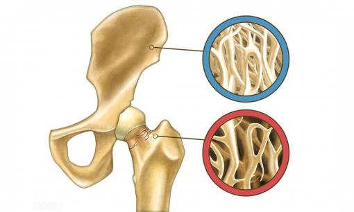Làm thế nào để ngăn ngừa mất canxi xương sau khi phụ nữ 45 tuổi? Hãy chú ý đến 4 chi tiết này 