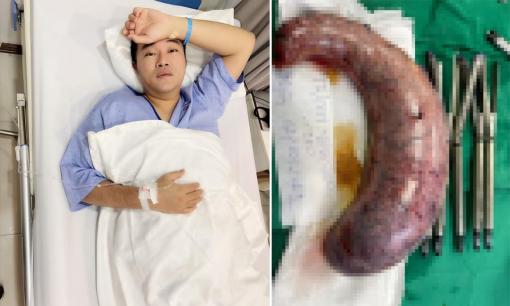 Ca sĩ Minh Quân gây ám ảnh khi đăng ảnh dạ dày của mình bị cắt 80%