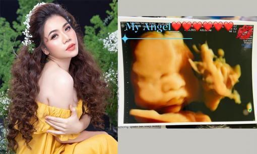 Ca sĩ Mỹ Dung lần đầu công khai ảnh siêu âm, tiết lộ đang mang bầu lần 3 ở tuổi U40