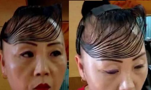 Chi gần 150 triệu để cấy tóc chữa hói, kiểu tóc mới của người phụ nữ khiến ai nhìn vào cũng không chịu nổi