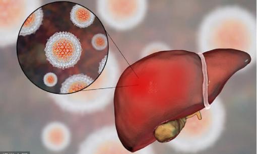 Ăn một miếng tương đương với 3 ly rượu! Bác sĩ gan mật: Nếu bạn ăn thường xuyên thì dù lá gan có khỏe đến đâu cũng không thể chịu được