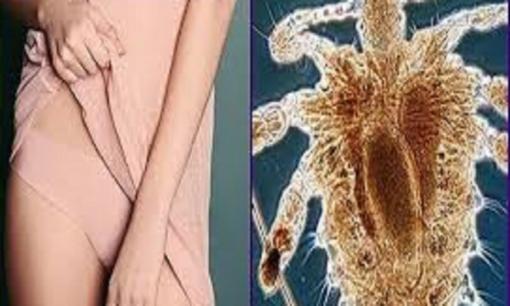 Rận mu là gì? Tại sao ngày càng nhiều người bị nhiễm? Nó lây lan như thế nào?