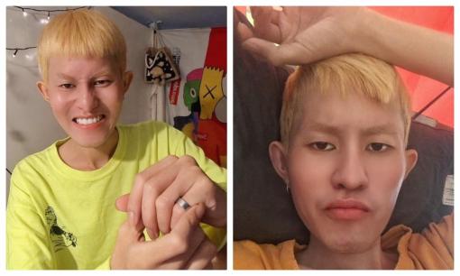 Xót xa với những hình ảnh cố gắng lạc quan vui vẻ lúc bệnh tật của cố ca sĩ Chí Thành