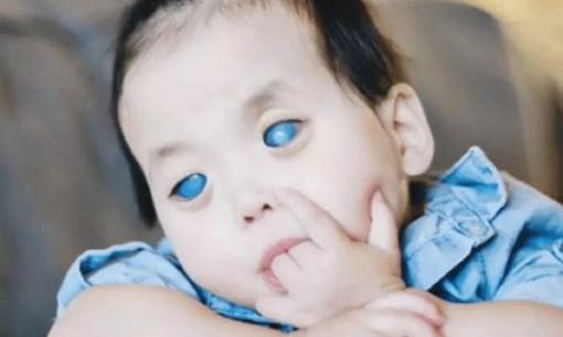 Bé gái 'mắt xanh' người Trung Quốc bị bỏ rơi, được cặp vợ chồng người Mỹ nhận nuôi, tới giờ thay đổi khó nhận ra