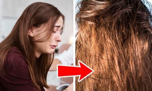 Những nguyên nhân phổ biến khiến mái tóc nhanh bết dính và cách khắc phục