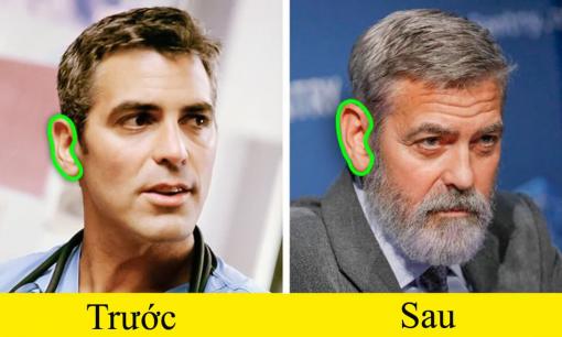 Tai và mũi của chúng ta đều sẽ to dần theo thời gian, khoa học nói gì về hiện tượng này?