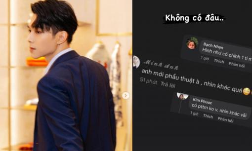 Anh Tú nói gì khi bất ngờ bị fan chất vấn phẫu thuật thẩm mỹ?