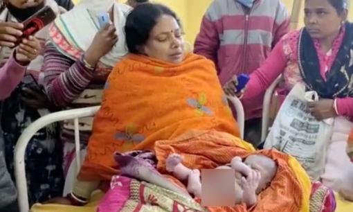 Ấn Độ: Em bé sinh ra với bốn tay và bốn chân bỗng dưng nổi tiếng