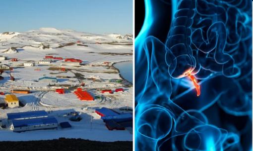 Thị trấn hẻo lánh yêu cầu phải cắt bỏ ruột thừa mới được định cư sinh sống