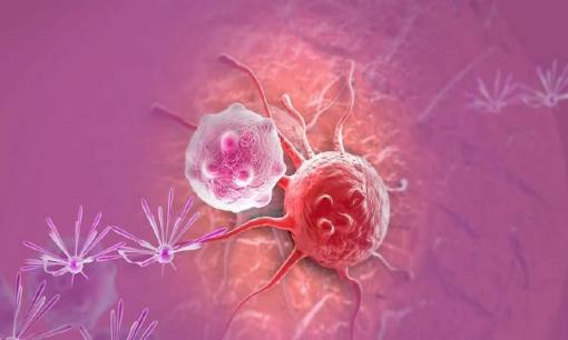 6 thói quen ăn uống trong cuộc sống này có thể đang 'nuôi' tế bào ung thư, hãy xem bạn chiếm bao nhiêu phần trăm?