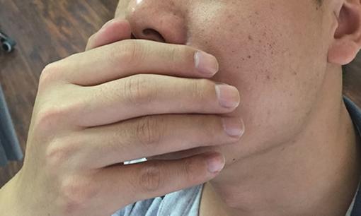 Trước khi ung thư miệng xuất hiện, bạn có thể có mùi này trong miệng! Làm thế nào để ngăn ngừa ung thư miệng?