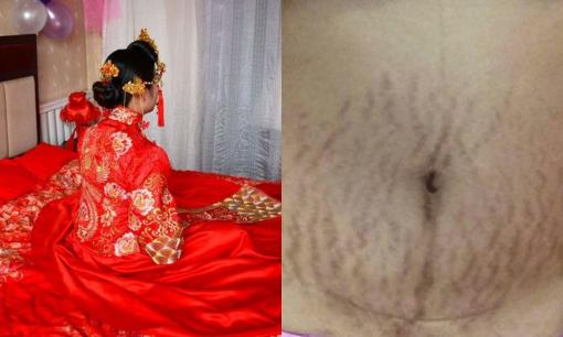 Người chồng phát hiện nếp rạn da trên bụng vợ trong đêm tân hôn đã đuổi cô ra khỏi nhà, sáng hôm sau mở cửa thì sững sờ