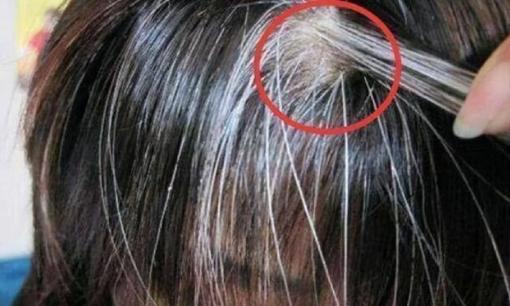 Phụ nữ có tóc trắng trên đầu ngày càng nhiều, đừng lúc nào cũng nghĩ rằng do già, có thể cơ thể thiếu 3 chất dinh dưỡng này