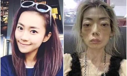 Nhan sắc hiện tại của cựu mẫu nữ Hong Kong - Ngũ Trí Hằng: Từng gây sốc với diện mạo da bọc xương, già nua như bà lão 