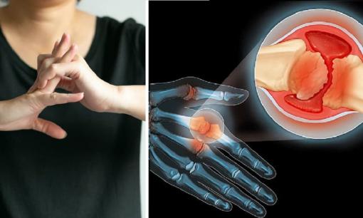 Tại sao bẻ khớp lại phát ra tiếng 'lục khục'? Bẻ khớp không hề có hại và thậm chí có thể phục vụ một mục đích hữu ích