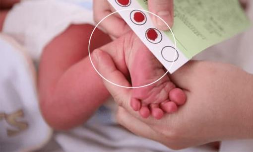 Tại sao bạn cần kiểm tra máu gót chân khi trẻ vừa mới sinh ra?