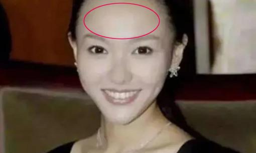 Người phụ nữ có sọc trên trán có tính khí xấu và tính cách kiêu hãnh, dễ khiến đàn ông nản lòng!