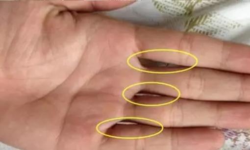 Khi ghép các ngón tay lại với nhau thì có bao nhiêu lỗ? Hóa ra nó có thể phản ánh cả tính cách và mức độ giàu có của bạn