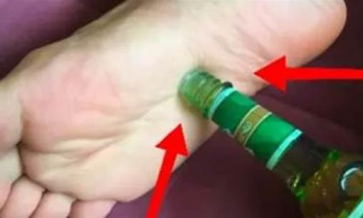 Nhỏ nước toilet vào lòng bàn chân, cứ 10 người thì 9 người không biết để làm gì, đọc xong sẽ cảm ơn