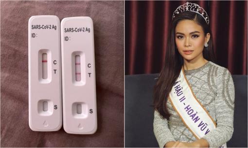 Á hậu Mâu Thủy dương tính với Covid-19