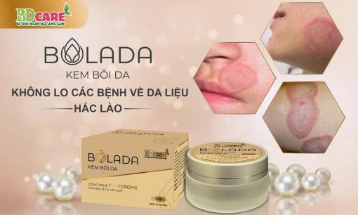 Kem bôi da Bolada - Hiệu quả đi đôi với an toàn, nói không với Corticoid