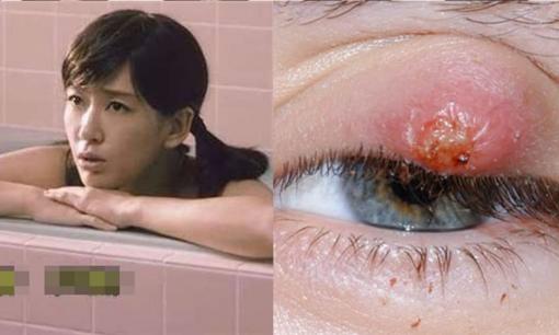 Nhìn trộm tắm sẽ gây ra mắt lẹo? Hóa ra 'thứ này' chính là kẻ sát nhân, bạn nên biết cách xử lý chính xác...