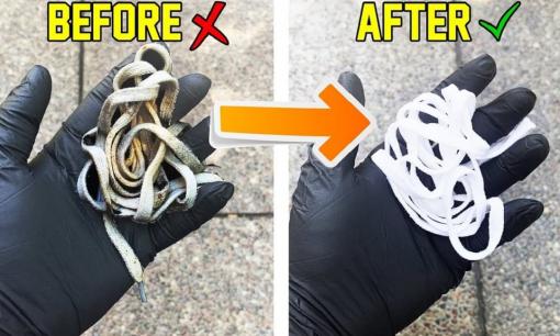 Công thức và các bước làm sạch dây giày trắng, ai cũng nên biết!