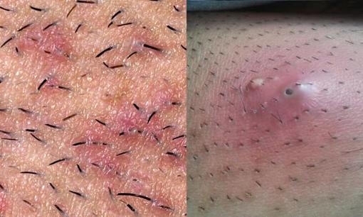 Bảy cách dạy bạn giải quyết nhanh chóng tình trạng “lông mọc ngược”! 