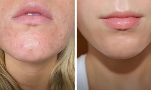 Theo các chuyên gia nên rửa mặt trong thời gian tối thiểu bao nhiêu giây? Nhiều người làm chưa đúng, bảo sao da hay nổi mụn