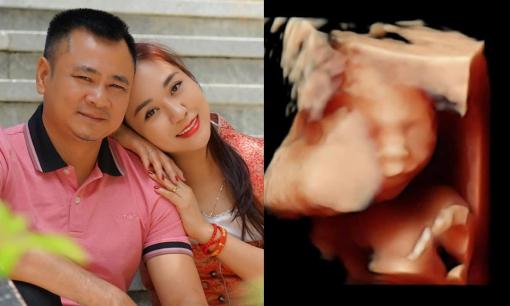 Vợ nghệ sĩ Tự Long mang bầu lần 3, hé lộ luôn giới tính của thai nhi