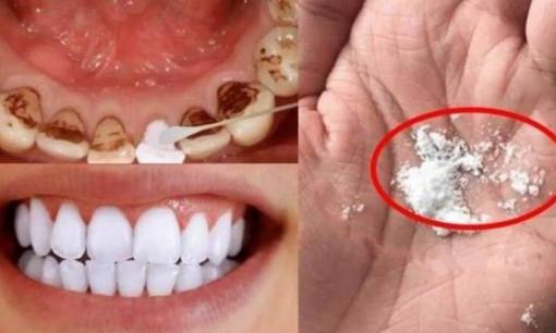 Không rửa răng vàng bằng nước muối! Bỏ thứ này vào nước súc miệng, lau nhẹ sẽ 'trả lại hàm răng trắng bóng', hơi thở thơm mát hơn
