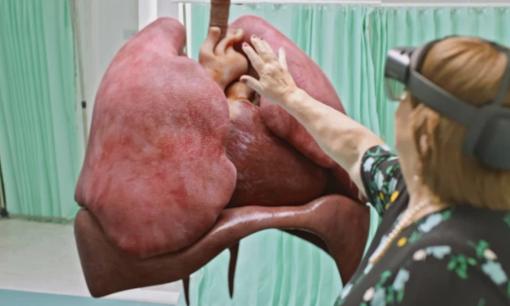 Rùng mình hình ảnh phổi bị COVID-19 tấn công