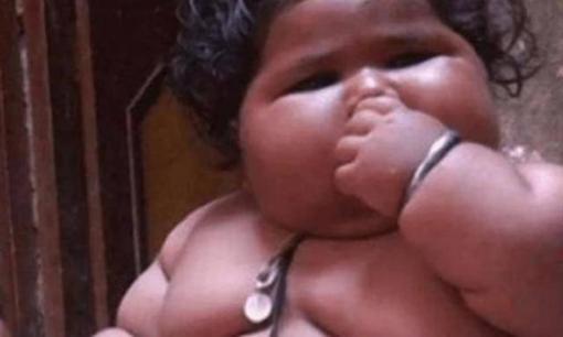 Cậu bé 1 tuổi nặng tới 45 kí, ăn quá mức khiến bố mẹ lo không nuôi nổi, bây giờ ra sao?