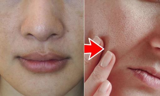 6 sai lầm khi chăm sóc da khiến lỗ chân lông của bạn ngày càng to hơn 