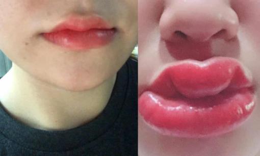 Cô gái trẻ đăng ảnh trước và sau khi phun xăm môi, nhìn qua chị em nào cũng 'hết hồn'